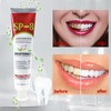 VLUVLA 3pcs SP-8 Probiotic Toothpaste 120g, Ultra Whitening & Deep