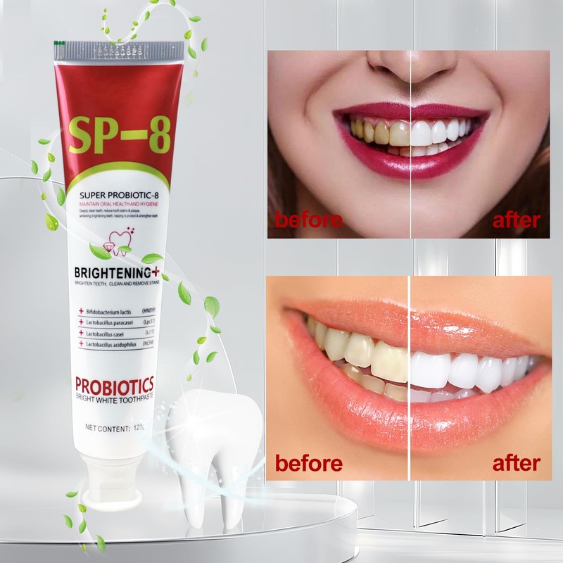 VLUVLA 3pcs SP-8 Probiotic Toothpaste 120g, Ultra Whitening & Deep