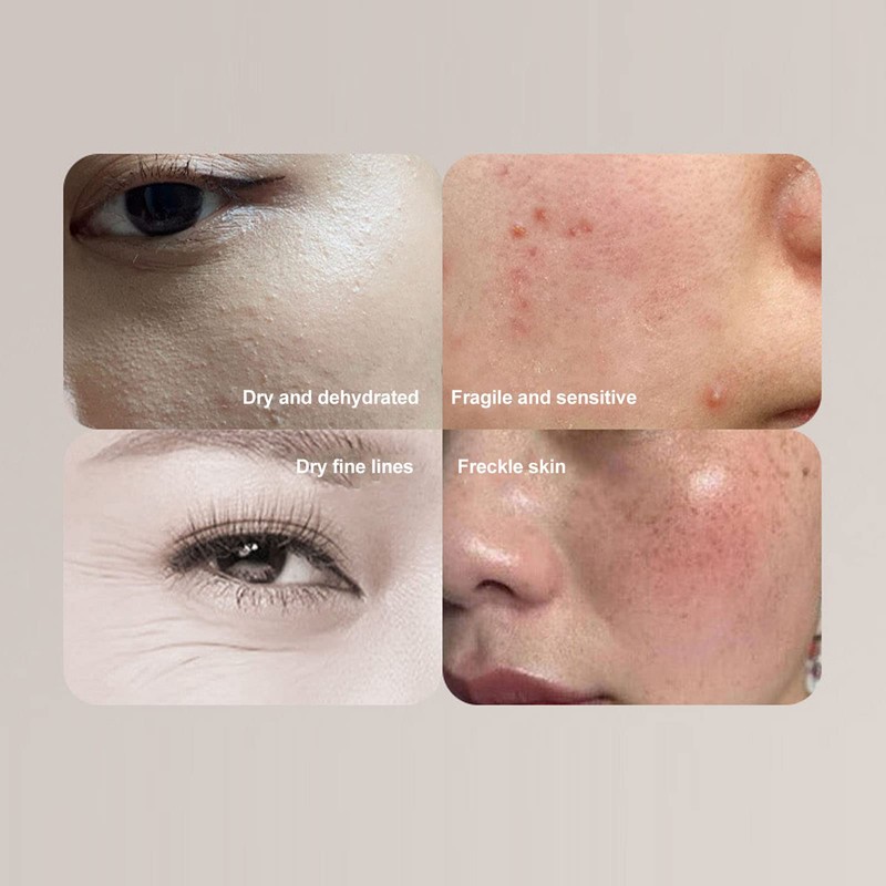 Skin Moisture Analyzer, Water Oil Tester for Skin Care, Digital