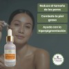 Serum Facial Niacinamida 30 Ml - Reduce Poros Y Grasa