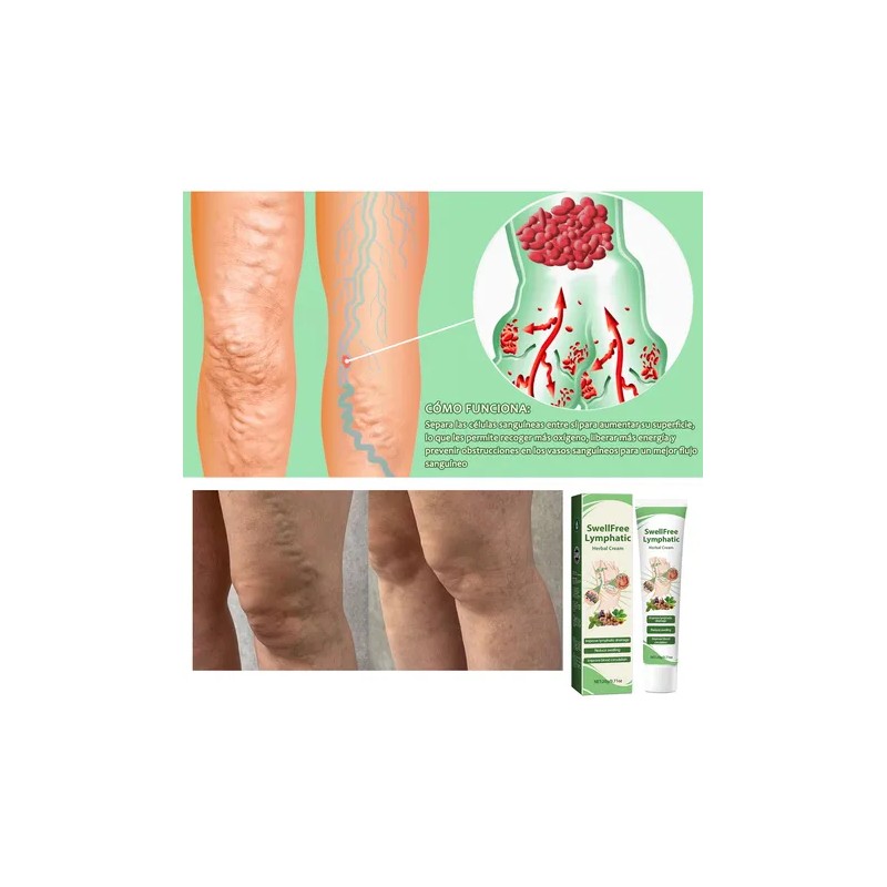 Planta Pomada Para El Ccuidado Linfático Cuidado Crema 20g