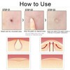 Rpanle Acne Patches[180 Pcs], Invisible Hydrocolloid Spot Patches, Dots for