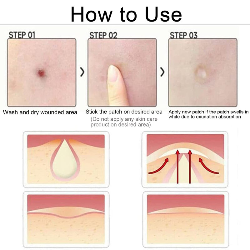 Rpanle Acne Patches[180 Pcs], Invisible Hydrocolloid Spot Patches, Dots for