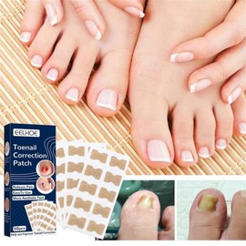 Health - Parche corrector de uñas de los pies, 50/100/150 unidades/juego de parches universales para uñas de los pies, ultrafinos y fuertes, cinta correctora de presión, calcomanías encarnadas de recuperación (150 unidades)
