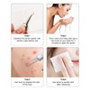 ALXBSONE Blackhead Remover Set of 8 Comedone Extractor Tools Stainless