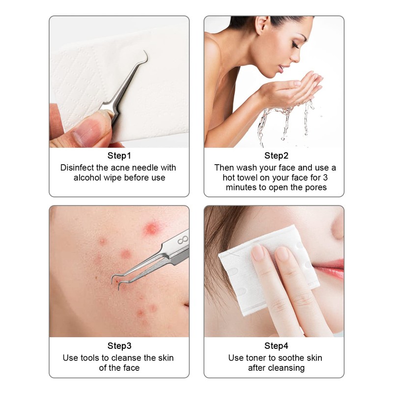 ALXBSONE Blackhead Remover Set of 8 Comedone Extractor Tools Stainless