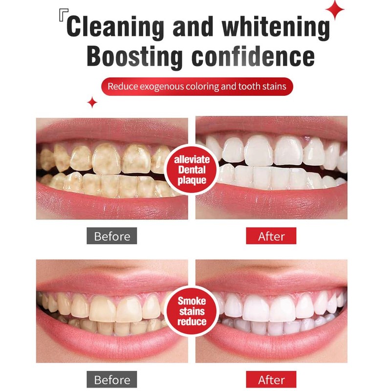 SP-8 Ultra Whitening Toothpaste, 2PCS SP8 Probiotics Toothpaste Brightening, Deep