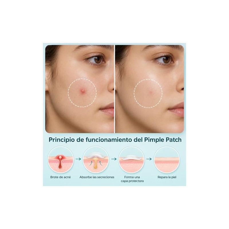 720PCS Parches para Acne, Pimple Patch, Parches para Espinillas, Cubrir