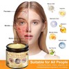 Bee Venom Comprehensive Cream, 2025 New Model Bee Venom All-In-One