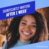 TheraBreath Whitening Toothpaste, Gentle Peroxide-Free Teeth Whitening in 1 Week