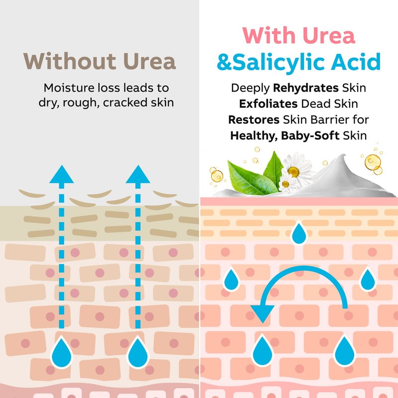 Adellina Urea Cream 40 Percent for Feet Maximum Strength, Urea