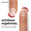 alessandro SOS Nail Repair Serum - Nail Serum for Brittle