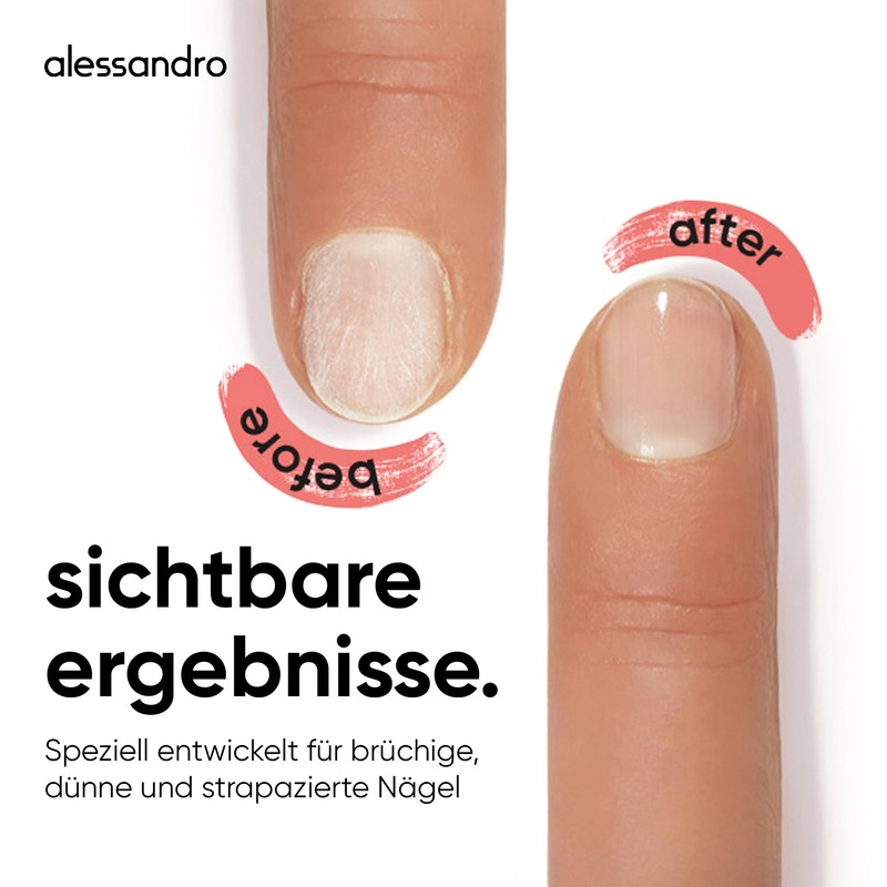 alessandro SOS Nail Repair Serum - Nail Serum for Brittle