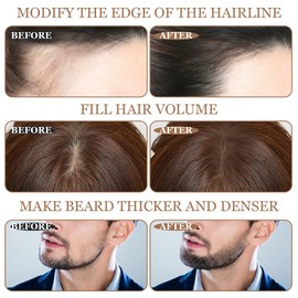 LOPHE Ansatzpuder fr M?nner und Frauen, Haarverdichtungs Ansatzpuder, Schnell Abdeckender Wurzel-Concealer mit Haarkreide, Haaransatz-Shading-Concealer-Puder zum Auffllen von Dnnem Haare Dunkelbraun