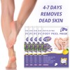 FUNNIR Foot Peeling Mask (5 Pack) Exfoliant for Peeling Off