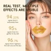 Mascarilla Labial Laikou Con Colágeno De Caracol, Zql1