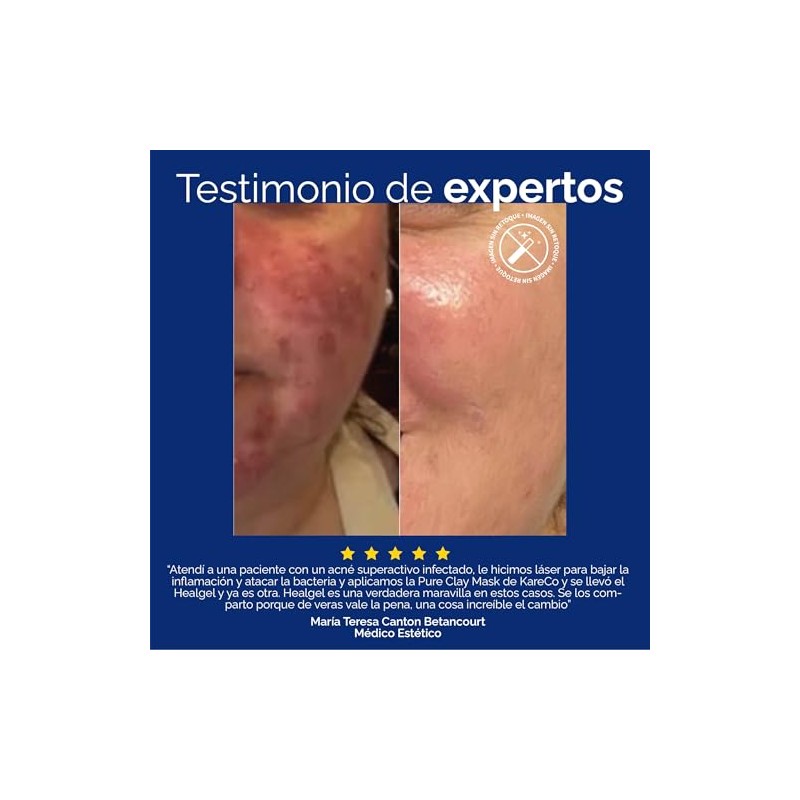 KARECO Healgel Restorative. Gel hidratante facial dermatológico con Niacinamida +