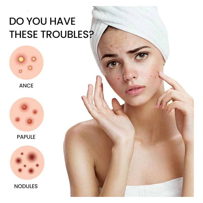 🔥 240pzs mascarillas parches para el acne espinillas granos Vitaminas