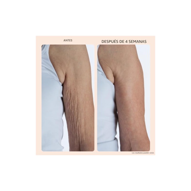 Crépe Erase Advanced Body Repair Treatment With Trufirm Complex Super