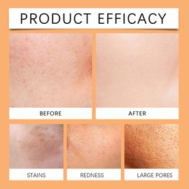 Vitamin C+Gently Brightens and Refreshes The Skin. Cleansing Oil, Gentle Cleanser, Daily Brightening Cleanser, Cleanser for Dissolving Makeup and Removing Daily Impurities-Suitable for All Skin Types