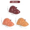 Simedutech Silicone Alcoholic Fatty Liver Model, Pathological Liver Replica for