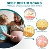 Silicone Scar Sheets (1.6"x 158" Roll-4M), Silicone Scar Tape for