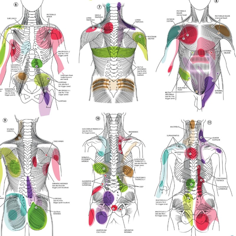 Anatomy Lab Trigger Points I Poster, LAMINATED, Anatomy and Physiology