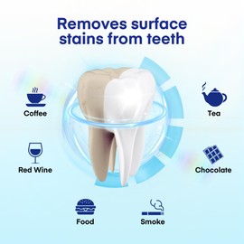 Pearl Smile Teeth Whitening Strips – Pap Formula for Gentle Whitening – Hydroxyapatite & Xylitol for Enamel Care – No Sensitivity, Non-Slip – 14-Day Supply – Fresh Mint Flavor(Pack of 1)