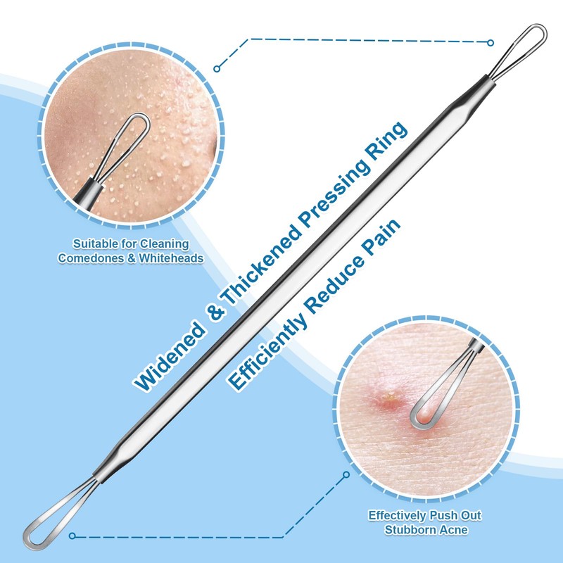Vybiekr Stainless Steel Blackhead Remover, Pimple Extractor, Pimple Popper, Comedone