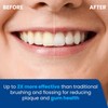 Electric Toothbrush and Water Flosser - Water Flossers for Teeth