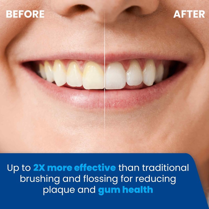 Electric Toothbrush and Water Flosser - Water Flossers for Teeth