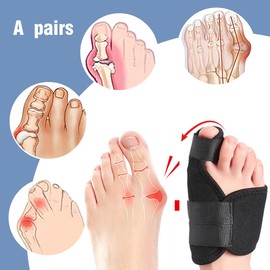 Hallux Valgus Correction Splint for the Foot Including for Day and Night - Universal Size - BPA Free - Night Splint for Men and Women