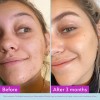 Tónico Facial Good Molecules Niacinamida Y Arbutina