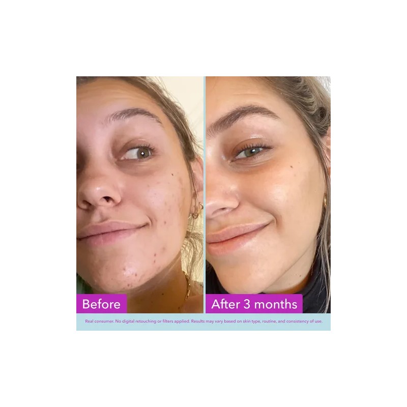 Tónico Facial Good Molecules Niacinamida Y Arbutina
