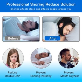 Chin Strap for Users Anti Snoring Devices 2 Pack - Breathable Chin Strap Snoring Solution, Effectively Reduce Snoring, Non-Stick Hair, Anti Snoring Devices Breathable and Reusable,Don't Fade