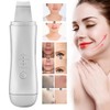 Ultrasonic Skin Scrubber Blackhead Removal Exfoliating Face Massage Pore Cleaner