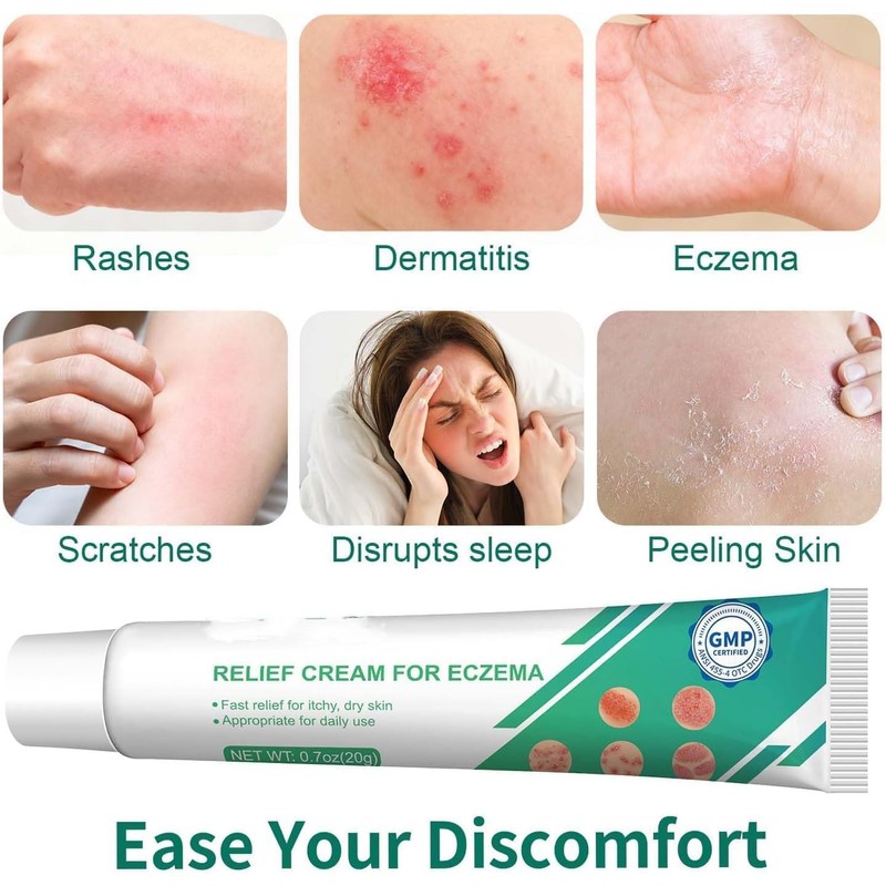 Eczema Cream Anti Itch Cream Maximum Strength