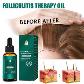 Hair Oil, Pack of 2 Hair Conditioner for Hair and Scalp, Hair Oil, Strengthening for Healthy Hair Growth, as and Hair Treatment, Used to Strengthen Hair and Repair Damaged Hair