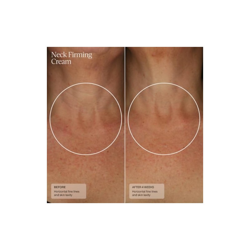 Sente Crema Reafirmante Para El Cuello Senté Para Piel Arrugada