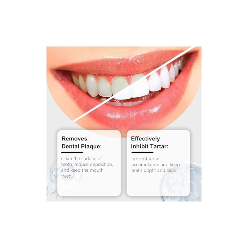 2Pcs 10% Hydroxyapatite Toothpaste,Nano-Hydroxyapatite Toothpaste for Advanced Enamel Protection,Fluoride Free