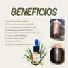 Aceite Capilar Ozonizado Anti-caída De Cabello 10ml