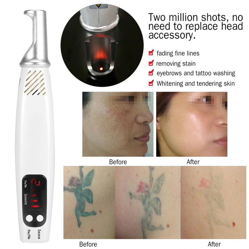 Handheald Red Light Picosecond Laser Pen Scar Tattoo Removal Melanin