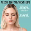 Base Labs Piercing Bump Treatment Saline Drops | Keloid Removal