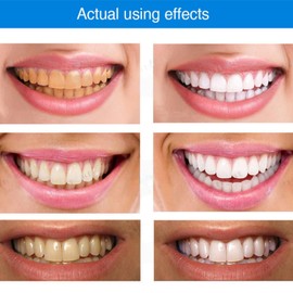 4 Pcs Gum Repair Gel,Gum Shield Treament Gel,Gums Protect Repaired Gels,Revitalizes Gums and Whitens Teeth,Natural Toothpaste Treatment,Fresh Breath,Deeply Cleaning,Oral Care,Instant Whitening