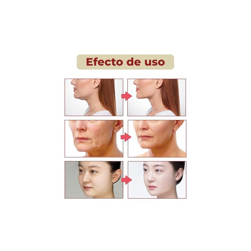 Mebix TRD Cinta Adhesiva Kinesiológica Antiarrugas | Cuidado Facial Profesional