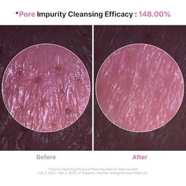 ZIGTAG - Gel Limpiador Facial 4 En 1 De Konjac: Exfoliación Suave Diaria, Limpieza Profunda, Cuidado De Los Poros Y Desmaquillante | Text...
