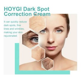 Ej La Crema Correctora De Manchas Aclara Las Manchas Oscuras