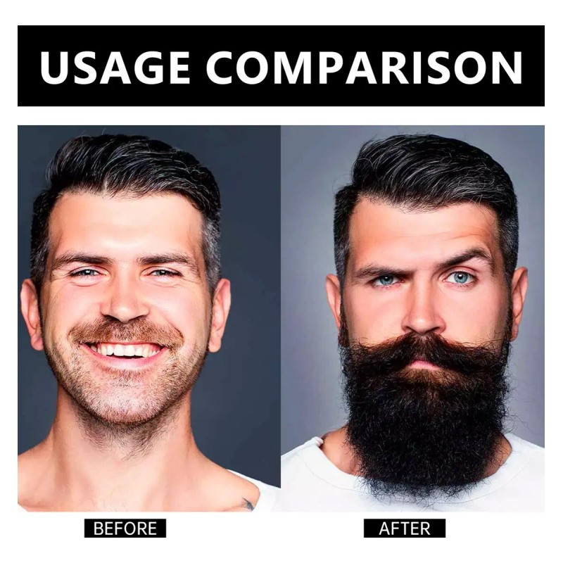 Balsamo Crecimiento Barba Bigote Estimulante Barba