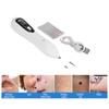 Professional Spot Tattoo Freckle Removal Machine No Bleeding Mole Dot