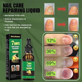 Hola Honey 7 Days Ginger Nail , moisturizes and thickens nails - longer, stronger and brighter nails with vitamins B and E Moisturizer Manicure Repair Comfort - Colour: 3 pcs ( Buy 3 get 1 free ! )